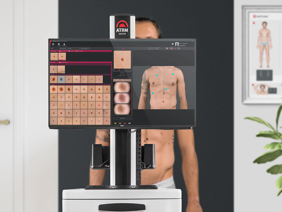 Hochtechnologische Hautanalyse mit Fotofinder-Gerät zeigt auf Monitor Nahaufnahmen von Hautstellen und eine Ganzkörperansicht eines Oberkörpers mit Markierungen